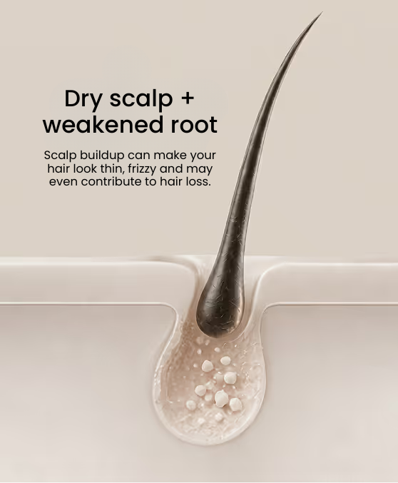 THINNING + SHEDDING